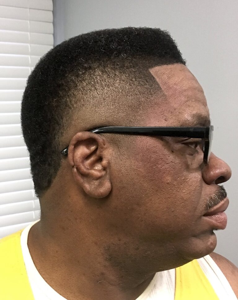 Man after a precise fade haircut